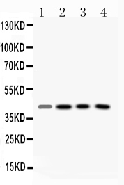 Western blot analysis of VASP using anti-VASP antibody (A00303-1). Electrophoresis was performed on a 5-20% SDS-PAGE gel at 70V (Stacking gel) / 90V (Resolving gel) for 2-3 hours. The sample well of each lane was loaded with 50ug of sample under reducing conditions. Lane 1: rat liver tissue lysates, Lane 2: mouse kidney tissue lysates, Lane 3: HELA whole cell lysates, Lane 4: HEPG2 whole cell lysates. After Electrophoresis, proteins were transferred to a Nitrocellulose membrane at 150mA for 50-90 minutes. Blocked the membrane with 5% Non-fat Milk/ TBS for 1.5 hour at RT. The membrane was incubated with rabbit anti-VASP antigen affinity purified polyclonal antibody (Catalog # A00303-1) at 0.5 μg/mL overnight at 4°C, then washed with TBS-0.1%Tween 3 times with 5 minutes each and probed with a goat anti-rabbit IgG-HRP secondary antibody at a dilution of 1:10000 for 1.5 hour at RT. The signal is developed using an Enhanced Chemiluminescent detection (ECL) kit (Catalog # EK1002) with Tanon 5200 system. A specific band was detected for VASP at approximately 40KD. The expected band size for VASP is at 40KD.