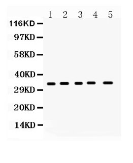 Western blot analysis of CCS using anti-CCS antibody (A00314-1).