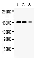 Western blot analysis of JAK1 using anti-JAK1 antibody (A00330).