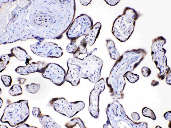 IHC analysis of Angiopoietin-2 using anti-Angiopoietin-2 antibody (A00370).