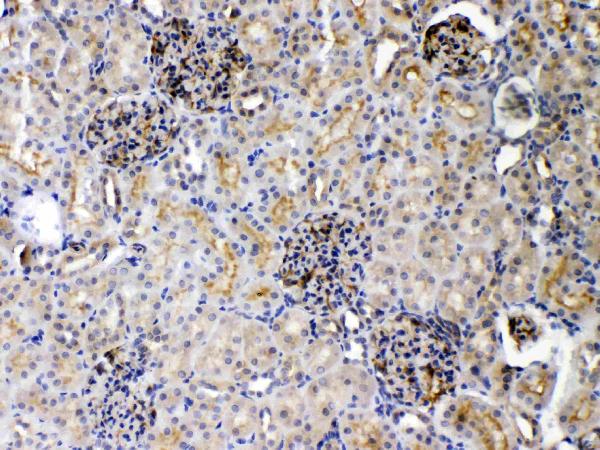 IHC analysis of DR5 using anti-DR5 antibody (A00410).