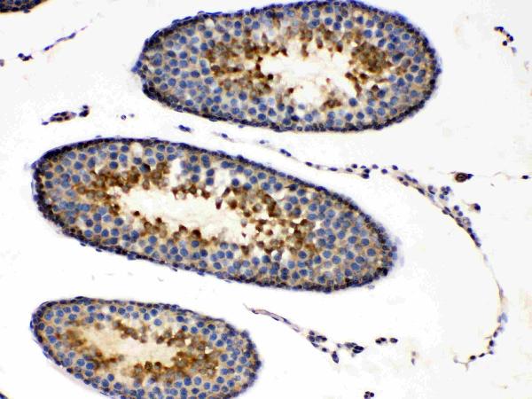 IHC analysis of PRKAR1A using anti-PRKAR1A antibody (A00699-1).