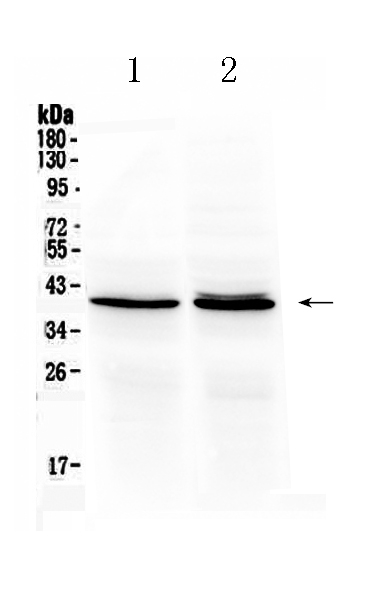 Western blot analysis of OTC using anti-OTC antibody (A00721-1).