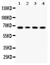 Western blot analysis of LBP using anti-LBP antibody (A00809-1).