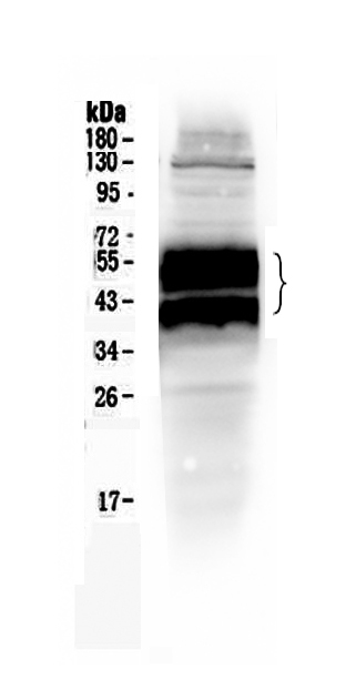 Western blot analysis of PLAUR using anti-PLAUR antibody (A00993-1).