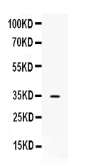 Western blot analysis of NAT1 using anti-NAT1 antibody (A01386-1).