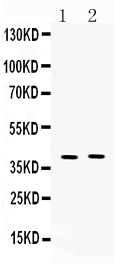 Western blot analysis of MC3 Receptor using anti-MC3 Receptor antibody (A02841-2).
