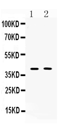 Western blot analysis of Islet 1 using anti-Islet 1 antibody (A02969-1).