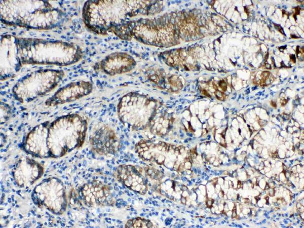 IHC analysis of ALDH1A3 using anti-ALDH1A3 antibody (A03030).