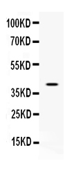 Western blot analysis of CD48 using anti-CD48 antibody (A03281-1).