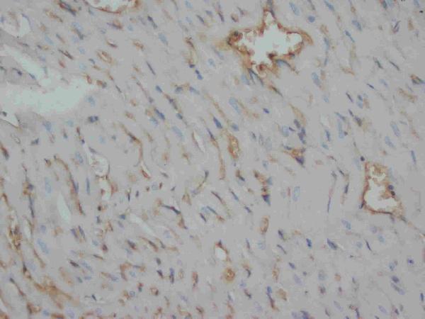 IHC analysis of Desmin using anti-Desmin antibody (MA1036).