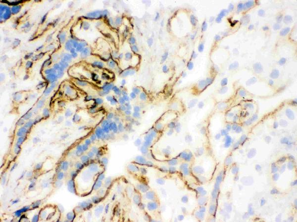 IHC analysis of Vinculin using anti-Vinculin antibody (MA1103). Vinculin was detected in frozen section of human placenta tissues. The tissue section was blocked with 10% goat serum. The tissue section was then incubated with 1μg/ml rabbit anti-Vinculin Antibody (MA1103) overnight at 4°C. Biotinylated goat anti-mouse IgG was used as secondary antibody and incubated for 30 minutes at 37°C. The tissue section was developed using Strepavidin-Biotin-Complex (SABC)(Catalog # SA1021) with DAB as the chromogen.