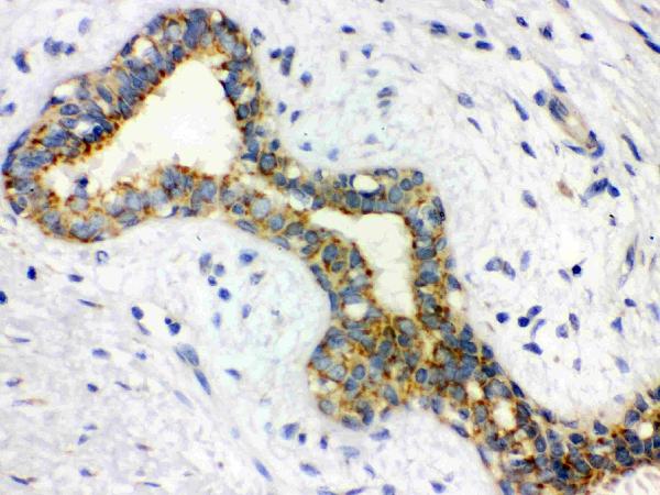 IHC analysis of Alpha-Actinin using anti-Alpha-Actinin antibody (MA1104).