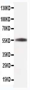 Anti-beta-Tubulin antibody (monoclonal), MA1112, Western blotting WB: Rat Skeletal Muscle Tissue Lysate