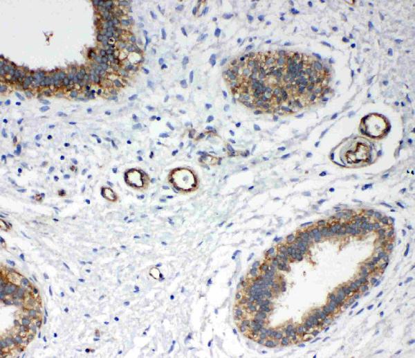 IHC analysis of Annexin IV/ANXA4 using anti-Annexin IV/ANXA4 antibody (PA1007-1).