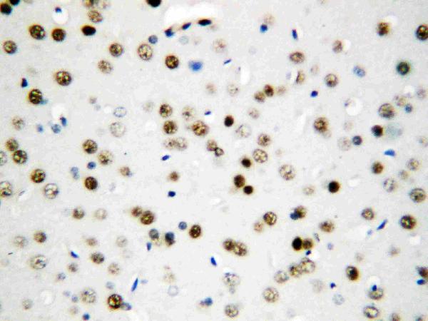 IHC analysis of API5 using anti-API5 antibody (PA1009).