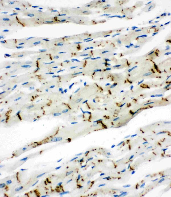 IHC analysis of Connexin 43/GJA1 using anti-Connexin 43/GJA1 antibody (PA1026-1). Connexin 43/GJA1 was detected in paraffin-embedded section of rat cardiac muscle tissues. Heat mediated antigen retrieval was performed in citrate buffer (pH6, epitope retrieval solution) for 20 mins. The tissue section was blocked with 10% goat serum. The tissue section was then incubated with 1μg/ml rabbit anti-Connexin 43/GJA1 Antibody (PA1026-1) overnight at 4°C. Biotinylated goat anti-rabbit IgG was used as secondary antibody and incubated for 30 minutes at 37°C. The tissue section was developed using Strepavidin-Biotin-Complex (SABC)(Catalog # SA1022) with DAB as the chromogen.