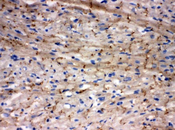 IHC analysis of Connexin 43/GJA1 using anti-Connexin 43/GJA1 antibody (PA1026-1). Connexin 43/GJA1 was detected in frozen section of rat cardiac muscle tissues. The tissue section was blocked with 10% goat serum. The tissue section was then incubated with 1μg/ml rabbit anti-Connexin 43/GJA1 Antibody (PA1026-1) overnight at 4°C. Biotinylated goat anti-rabbit IgG was used as secondary antibody and incubated for 30 minutes at 37°C. The tissue section was developed using Strepavidin-Biotin-Complex (SABC)(Catalog # SA1022) with DAB as the chromogen.