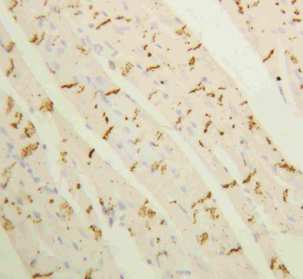 IHC analysis of Connexin 43/GJA1 using anti-Connexin 43/GJA1 antibody (PA1026). Connexin 43/GJA1 was detected in paraffin-embedded section of rat cardiac muscle tissues. Heat mediated antigen retrieval was performed in citrate buffer (pH6, epitope retrieval solution) for 20 mins. The tissue section was blocked with 10% goat serum. The tissue section was then incubated with 1μg/ml rabbit anti-Connexin 43/GJA1 Antibody (PA1026) overnight at 4°C. Biotinylated goat anti-rabbit IgG was used as secondary antibody and incubated for 30 minutes at 37°C. The tissue section was developed using Strepavidin-Biotin-Complex (SABC)(Catalog # SA1022) with DAB as the chromogen.