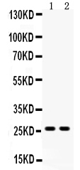 Western blot analysis of DUT using anti-DUT antibody (PA1030-1). Electrophoresis was performed on a 5-20% SDS-PAGE gel at 70V (Stacking gel) / 90V (Resolving gel) for 2-3 hours. The sample well of each lane was loaded with 50ug of sample under reducing conditions. Lane 1: HELA whole cell lysates, Lane 2: SMMC-7721 whole cell lysates. After Electrophoresis, proteins were transferred to a Nitrocellulose membrane at 150mA for 50-90 minutes. Blocked the membrane with 5% Non-fat Milk/ TBS for 1.5 hour at RT. The membrane was incubated with rabbit anti-DUT antigen affinity purified polyclonal antibody (Catalog # PA1030-1) at 0.5 μg/mL overnight at 4°C, then washed with TBS-0.1%Tween 3 times with 5 minutes each and probed with a goat anti-rabbit IgG-HRP secondary antibody at a dilution of 1:10000 for 1.5 hour at RT. The signal is developed using an Enhanced Chemiluminescent detection (ECL) kit (Catalog # EK1002) with Tanon 5200 system. A specific band was detected for DUT at approximately 27KD. The expected band size for DUT is at 27KD.