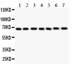 Western blot analysis of GAD67 using anti-GAD67 antibody (PA1036-1). Electrophoresis was performed on a 5-20% SDS-PAGE gel at 70V (Stacking gel) / 90V (Resolving gel) for 2-3 hours. The sample well of each lane was loaded with 50ug of sample under reducing conditions. Lane 1: Rat Brain Tissue Lysate, Lane 2: Rat Testis Tissue Lysate, Lane 3: MCF-7 Whole Cell Lysate, Lane 4: MM231 Whole Cell Lysate, Lane 5: HELA Whole Cell Lysate, Lane 6: SMMC Whole Cell Lysate, Lane 7: COLO320 Whole Cell Lysate. After Electrophoresis, proteins were transferred to a Nitrocellulose membrane at 150mA for 50-90 minutes. Blocked the membrane with 5% Non-fat Milk/ TBS for 1.5 hour at RT. The membrane was incubated with rabbit anti-GAD67 antigen affinity purified polyclonal antibody (Catalog # PA1036-1) at 0.5 μg/mL overnight at 4°C, then washed with TBS-0.1%Tween 3 times with 5 minutes each and probed with a goat anti-rabbit IgG-HRP secondary antibody at a dilution of 1:10000 for 1.5 hour at RT. The signal is developed using an Enhanced Chemiluminescent detection (ECL) kit (Catalog # EK1002) with Tanon 5200 system. A specific band was detected for GAD67 at approximately 67KD. The expected band size for GAD67 is at 67KD.