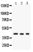 Anti-GAP43 antibody, PA1037, Western blotting All lanes: Anti GAP43 (PA1037) at 0.5ug/ml Lane 1: U87 Whole Cell Lysate at 40ug Lane 2: Rat Brain Tissue Lysate at 50ug Lane 3: Mouse Brain Tissue Lysate at 50ug Predicted bind size: 43KD Observed bind size: 43KD