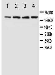 Anti-NMDAR2B antibody, PA1059, Western blotting Lane 1: Rat Brain Tissue Lysate Lane 2: Rat Brain Tissue Lysate Lane 3: Mouse Brain Tissue Lysate Lane 4: Mouse Brain Tissue Lysate