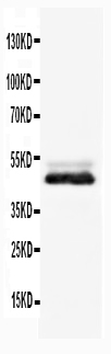 Anti-NSE antibody, PA1061, Western blotting WB: Rat Brain Tissue Lysate