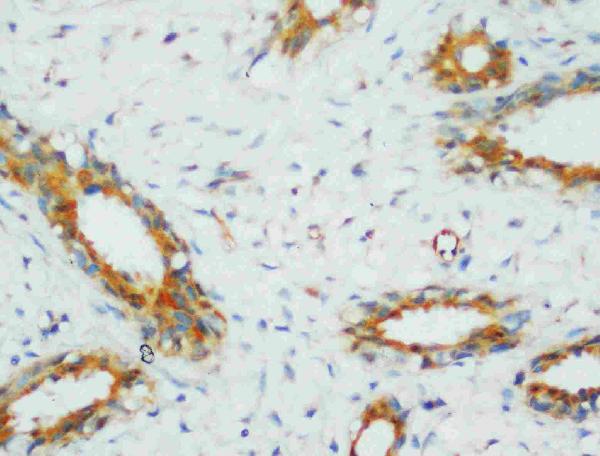 IHC analysis of PP2A-alpha using anti-PP2A-alpha antibody (PA1068).