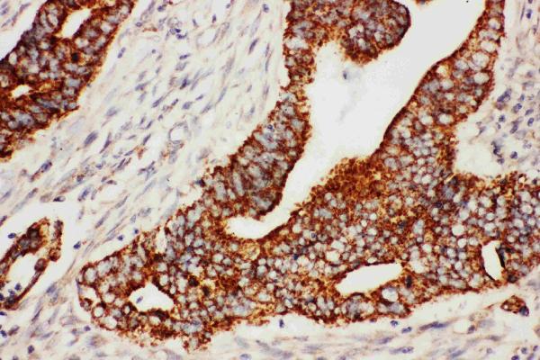 Anti-Secretogranin 3 antibody, PA1071, IHC(P) IHC(P): Human Rectal Cancer Tissue