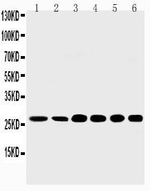 Anti-Sonic Hedgehog antibody, PA1072-1, Western blotting Lane 1: Rat Liver Tissue Lysate Lane 2: Rat Intestine Tissue Lysate Lane 3: HELA Cell Lysate Lane 4: A549 Cell Lysate Lane 5: SMMC Cell Lysate Lane 6: MM231 Cell Lysate