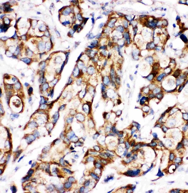 Anti-Sonic Hedgehog antibody, PA1072-1, IHC(P) IHC(P): Human Mammary Tissue