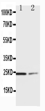 Anti-SOCS1 antibody, PA1074, Western blotting Lane 1: HT1080 Cell Lysate Lane 2: COLO320 Cell Lysate