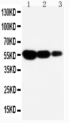 Anti-Fas antibody, PA1119, Western blotting Lane 1: Recombinant Mouse FAS Protein 10ng Lane 2: Recombinant Mouse FAS Protein 5ng Lane 3: Recombinant Mouse FAS Protein 2.5ng