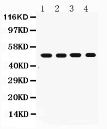 Western blot analysis of FAS expression in rat liver extract (lane 1), rat spleen extract (lane 2), rat brain extract (lane 3) and rat cardiac muscle extract (lane 4). FAS at 50KD was detected using rabbit anti-FAS Antigen Affinity purified polyclonal antibody (Catalog # PA1119) at 0.5 μg/mL. The blot was developed using chemiluminescence (ECL) method (Catalog # EK1002).