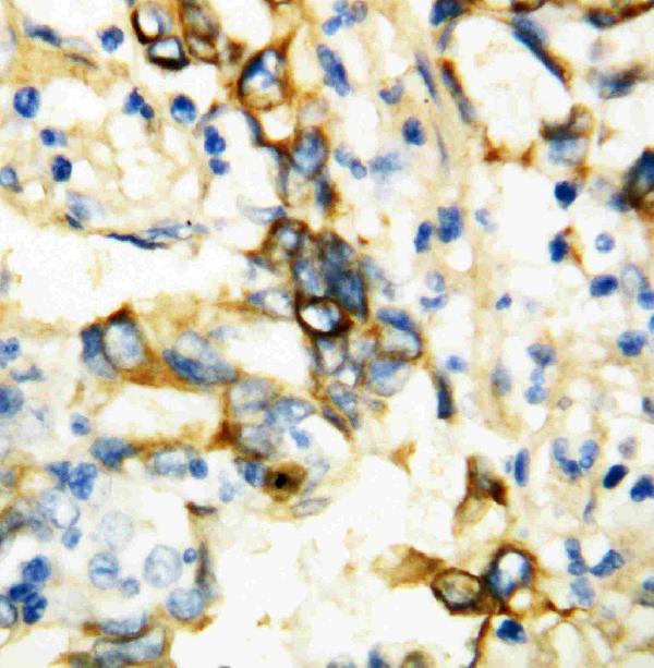 Anti-TNF Receptor I antibody, PA1210, IHC(P) IHC(P): Human Mammary Tissue