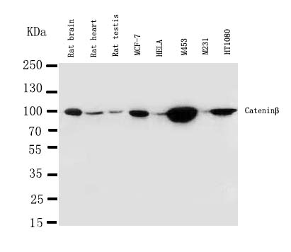 Anti-beta Catenin antibody, PA1212-1, Western blotting Lane 1: Rat Brain Tissue Lysate Lane 2: Rat Heart Tissue Lysate Lane 3: Rat Testis Tissue Lysate Lane 4: MCF-7 Cell Lysate Lane 5: HELA Cell Lysate Lane 6: M453 Cell Lysate Lane 7: M231 Cell Lysate