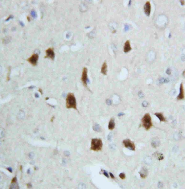 IHC analysis of Hsp70 using anti-Hsp70 antibody (PA1214). Hsp70 was detected in paraffin-embedded section of rat brain tissues. Heat mediated antigen retrieval was performed in citrate buffer (pH6, epitope retrieval solution) for 20 mins. The tissue section was blocked with 10% goat serum. The tissue section was then incubated with 1μg/ml rabbit anti-Hsp70 Antibody (PA1214) overnight at 4°C. Biotinylated goat anti-rabbit IgG was used as secondary antibody and incubated for 30 minutes at 37°C. The tissue section was developed using Strepavidin-Biotin-Complex (SABC)(Catalog # SA1022) with DAB as the chromogen.