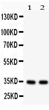 Anti-XAF1 antibody, PA1218, Western blotting All lanes: Anti XAF1 (PA1218) at 0.5ug/ml Lane 1: HEPG2 Whole Cell Lysate at 40ug Lane 2: HEPG2 Whole Cell Lysate at 40ug Predicted bind size: 34KD Observed bind size: 34KD