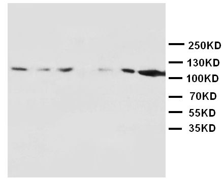 Anti-NMDAR1 antibody, PA1222, Western blotting Lane 1: Rat Brain Tissue Lysate Lane 2: Rat Brain Tissue Lysate Lane 3: Rat Liver Tissue Lysate Lane 4: Rat Heart Tissue Lysate Lane 5: MM453 Cell Lysate Lane 6: MM231 Cell Lysate Lane 7: HELA Cell Lysate