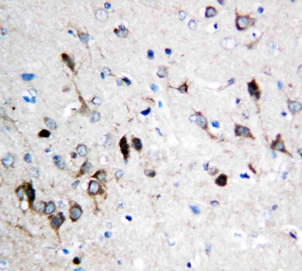 Anti-NMDAR1 antibody, PA1222, IHC(P) IHC(P): Rat Brain Tissue