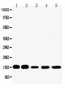 Anti-liver FABP antibody, PA1229-1, Western blotting Lane 1: Rat Liver Tissue Lysate Lane 2: Rat Kidney Tissue Lysate Lane 3: HELA Cell Lysate Lane 4: NEURO Cell Lysate Lane 5: SMMC Cell Lysate