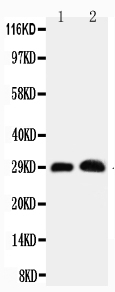 Anti-Aquaporin 5 antibody, PA1230, Western blotting Working concentration: 0.5μg/ml Lane 1: Rat Lung Tissue Lysate Lane 2: Rat Testis Tissue Lysate