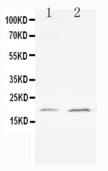 Anti-Bcl-XS antibody, PA1232, Western blotting All lanes: Anti Bcl-XS (PA1232) at 0.5ug/ml Lane 1: HELA Whole Cell Lysate at 40ug Lane 2: PC-12 Whole Cell Lysate at 40ug Predicted bind size: 19KD Observed bind size: 19KD