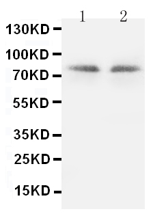 Anti-PKC gamma antibody, PA1234, Western blotting Lane 1: Rat Brain Tissue Lysate Lane 2: Rat Brain Tissue Lysate