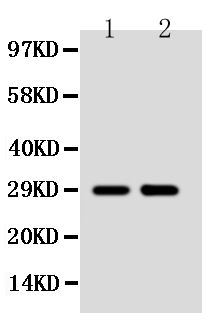 Anti-SSX2 antibody, PA1235, Western blotting Lane 1: MCF-7 Cell Lysate Lane 2: HELA Cell Lysate