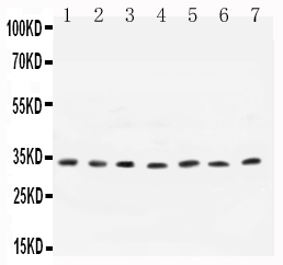 Western blot analysis of Cyclin D1 using anti-Cyclin D1 antibody (PA1245-2). Electrophoresis was performed on a 5-20% SDS-PAGE gel at 70V (Stacking gel) / 90V (Resolving gel) for 2-3 hours. The sample well of each lane was loaded with 50ug of sample under reducing conditions. Lane 1: Rat Testis Tissue Lysate, Lane 2: Human Placenta Tissue Lysate, Lane 3: Rat Brain Tissue Lysate, Lane 4: MCF-7 Whole Cell Lysate, Lane 5: COLO320 Whole Cell Lysate, Lane 6: SW620 Whole Cell Lysate, Lane 7: MM231 Whole Cell Lysate. After Electrophoresis, proteins were transferred to a Nitrocellulose membrane at 150mA for 50-90 minutes. Blocked the membrane with 5% Non-fat Milk/ TBS for 1.5 hour at RT. The membrane was incubated with rabbit anti-Cyclin D1 antigen affinity purified polyclonal antibody (Catalog # PA1245-2) at 0.5 μg/mL overnight at 4°C, then washed with TBS-0.1%Tween 3 times with 5 minutes each and probed with a goat anti-rabbit IgG-HRP secondary antibody at a dilution of 1:10000 for 1.5 hour at RT. The signal is developed using an Enhanced Chemiluminescent detection (ECL) kit (Catalog # EK1002) with Tanon 5200 system. A specific band was detected for Cyclin D1 at approximately 33KD. The expected band size for Cyclin D1 is at 33KD.