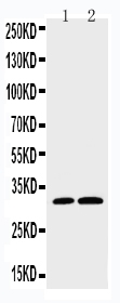 Anti-Caspase-3(P10), PA1302-1, Western blotting Lane 1: HELA Cell Lysate Lane 2: SMMC Cell Lysate