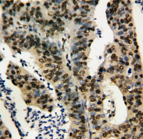 IHC analysis of TNFAIP1 using anti-TNFAIP1 antibody (PA1305).