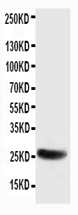 Anti-SNAP25 antibody, PA1315, Western blotting WB: Rat Brain Tissue Lysate